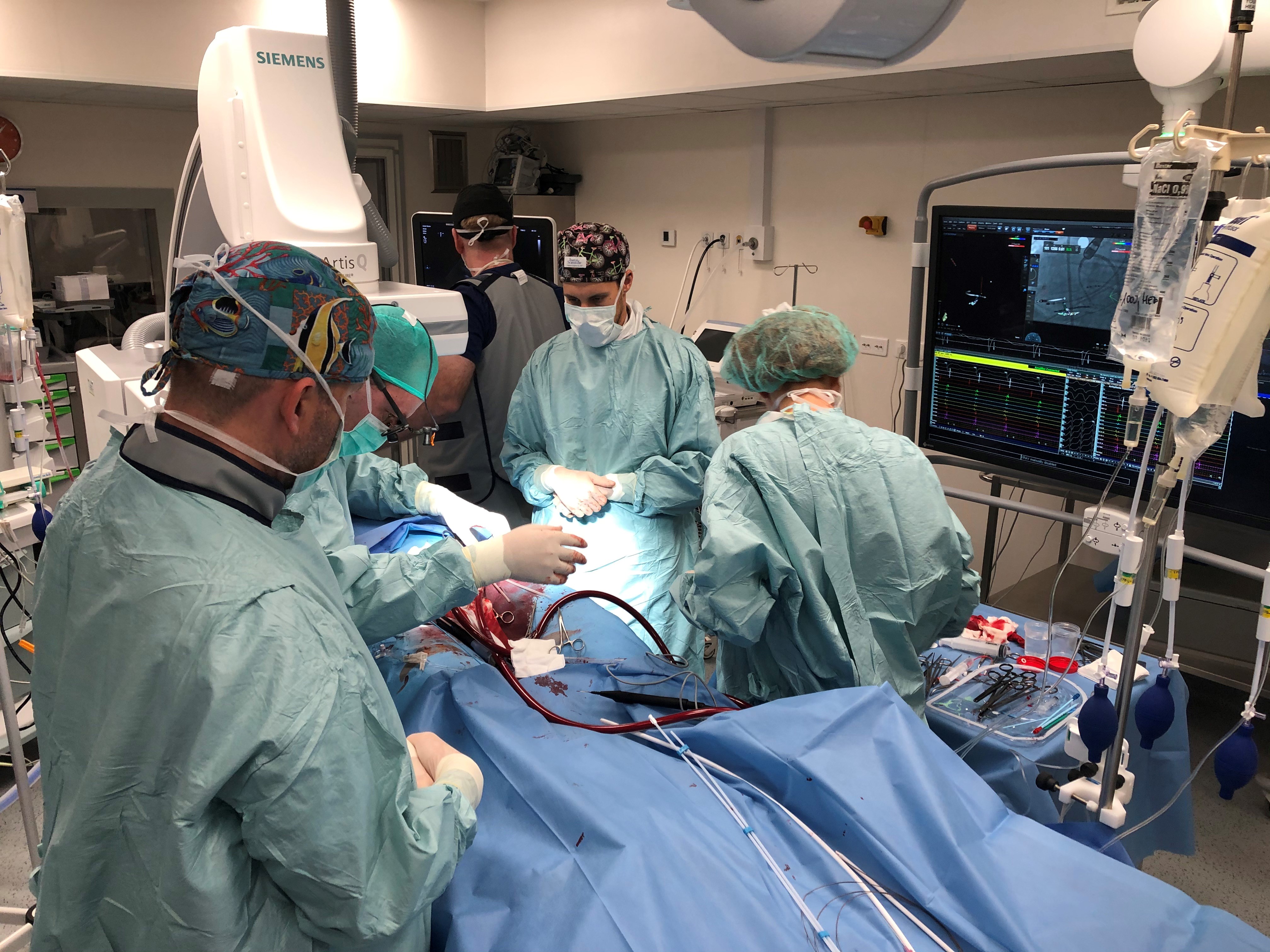 Ablation treatment with the support of ECMO taking place at the 1st Chair and Department of Cardiology 