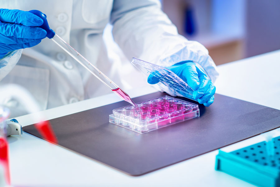 Osoba ubrana w fartuch aplikuje preparat do próbek laboratoryjnych. Na rękach ma niebieskie rękawiczki. Preparat jest koloru różowego.