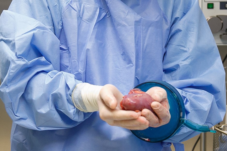 Lekarz w fartuchu medycznym trzyma w dłoniach, na których nosi rękawiczki, nerkę do przeszczepienia. W tle widać sprzęt medyczny.