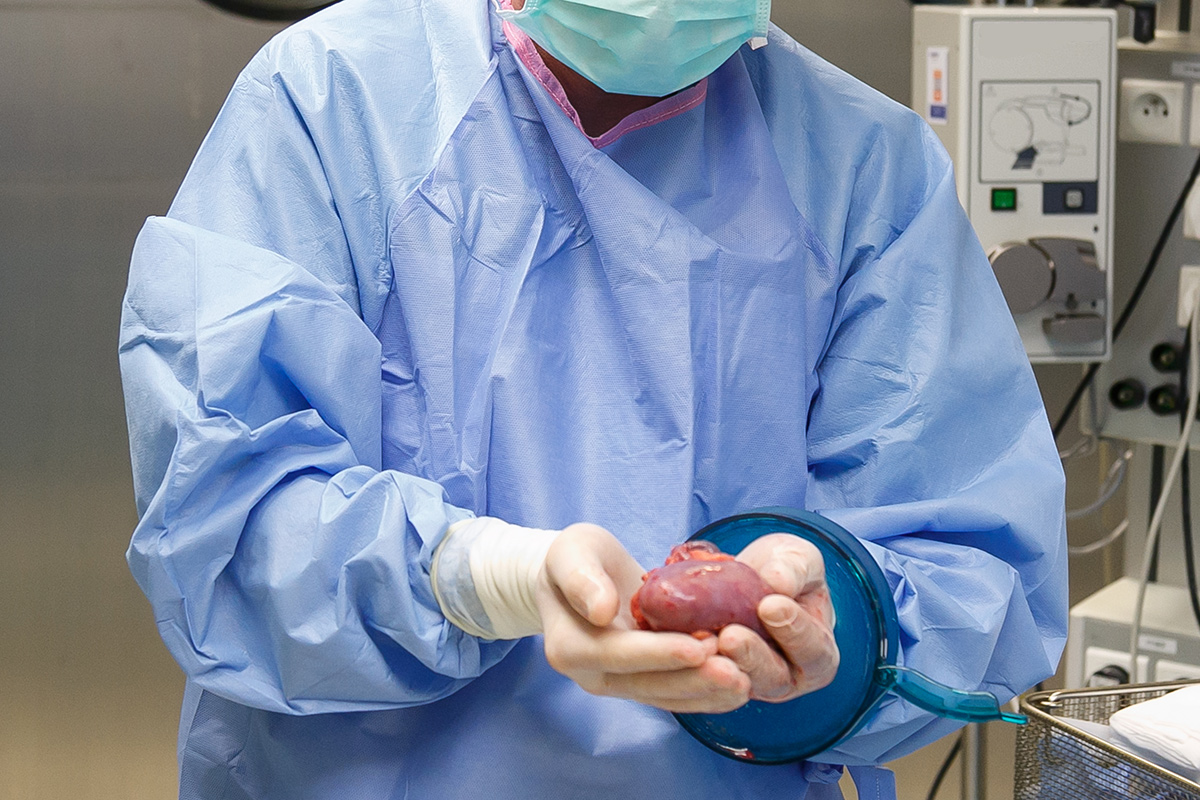 Lekarz w fartuchu medycznym trzyma w dłoniach, na których nosi rękawiczki, nerkę do przeszczepienia. W tle widać sprzęt medyczny.
