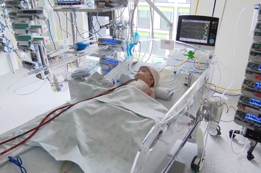 A small child is lying in a hospital crib in an intensive care unit, covered with a light blanket and connected to multiple medical devices, including a ventilator, vital signs monitor, and infusion pumps; specialized equipment, tubes, and a screen displaying heart activity are positioned around the bed.