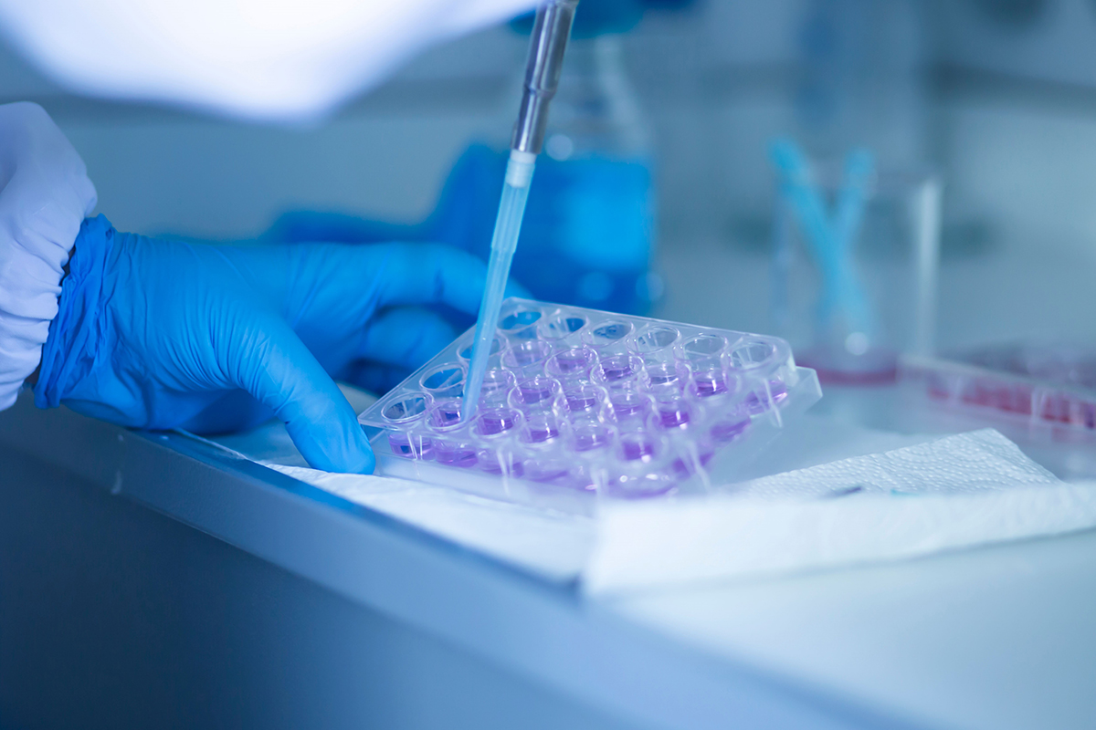 Na zbliżeniu widać ręce w rękawiczkach, które za pomocą pipety napełniają mikropłytkę fioletowym roztworem. Technik pracuje w laboratorium, otoczony fiolkami i sprzętem naukowym.