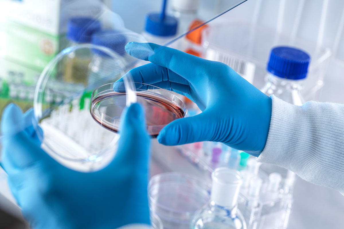 Zbliżenie na osobę w niebieskich rękawiczkach i białym fartuchu laboratoryjnym, trzymającą szalkę Petriego z czerwoną substancją w środku. Na blacie widoczne są zlewki, probówki i inne przyrządy laboratoryjne. Scena przypomina miejsce pracy, prawdopodobnie laboratorium.