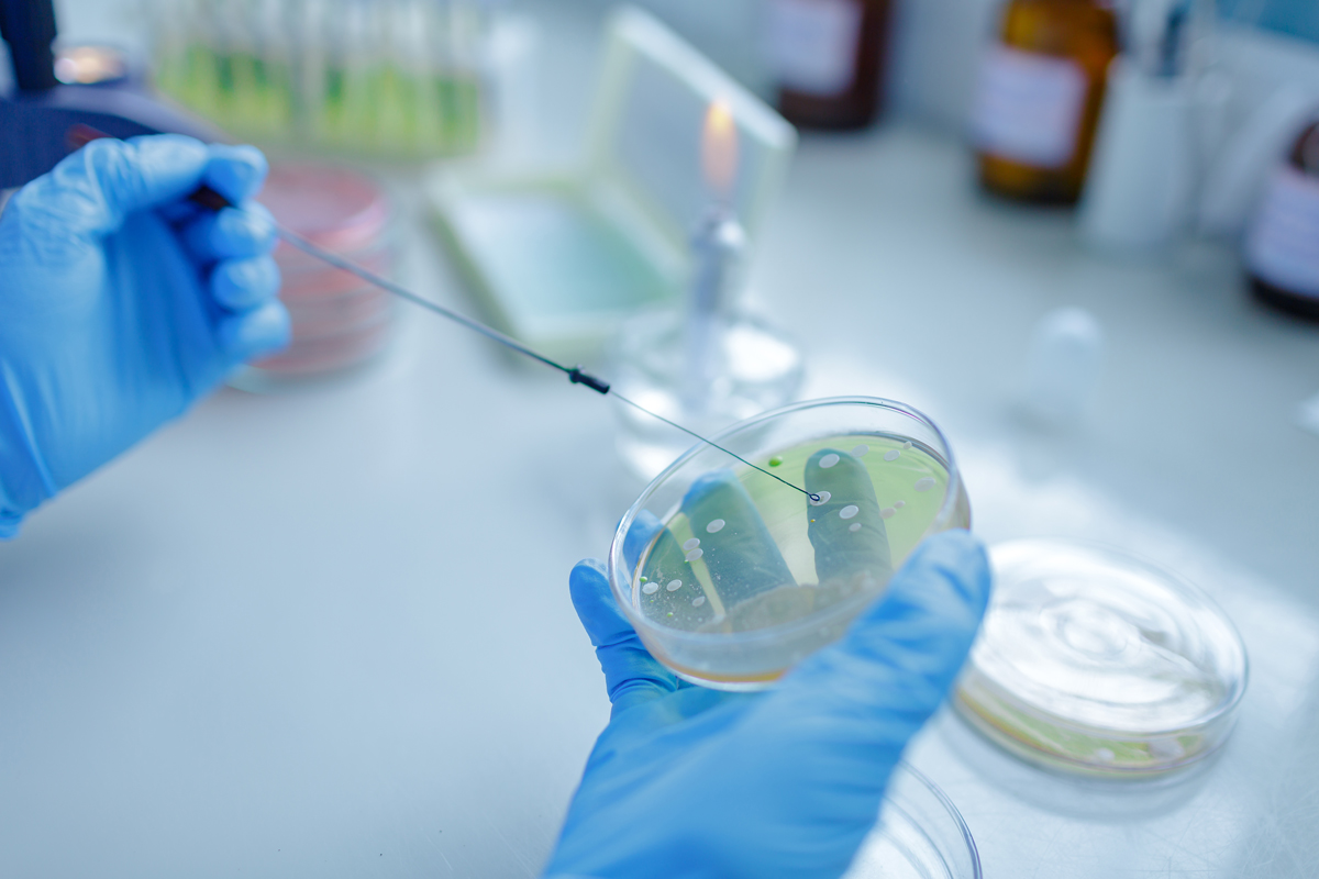 Osoba w rękawiczkach laboratoryjnych trzyma szalkę Petriego z podłożem hodowlanym i używa ezki do pobierania lub nanoszenia materiału. W tle widoczne są elementy wyposażenia laboratorium, w tym palnik oraz naczynia laboratoryjne.
