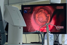 Ophthalmic surgeries broadcast live