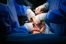 First heart transplantations at the UCC MUW  