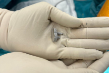 Implant w rękach lekarza.