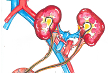 An illustration showing the technique of kidney transplantation. It shows the kidneys and blood vessels.