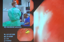 Grafika przedstawiająca procedura badania przełyku. 