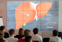 Uczestnicy zajęć oglądają na dużym ekranie ilustrację pokazującą zabieg ablacji na schematycznym rysunku wątroby.