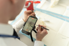 A person holds tweezers while recording a close-up medical procedure with a smartphone mounted on a small tripod.