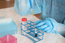 Osoba pobiera ciecz za pomocą pipety automatycznej do probówki umieszczonej w stojaku laboratoryjnym.