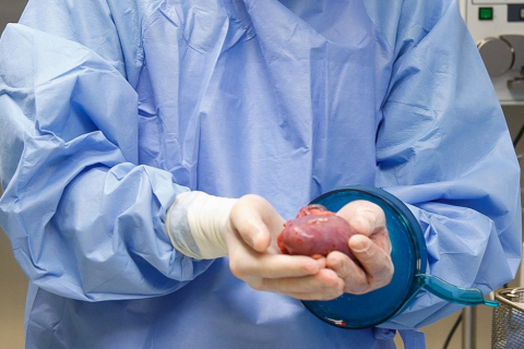 Lekarz w fartuchu medycznym trzyma w dłoniach, na których nosi rękawiczki, nerkę do przeszczepienia. W tle widać sprzęt medyczny.